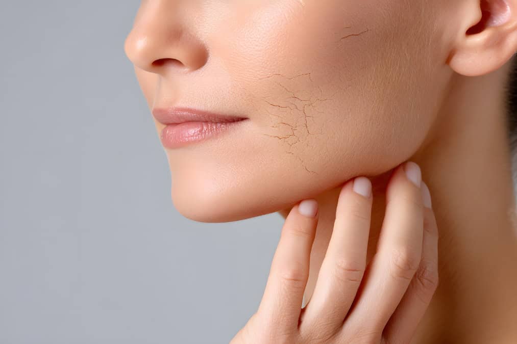 כמה טיפולי Morpheus8 צריך – ומה באמת משפיע על התוצאה